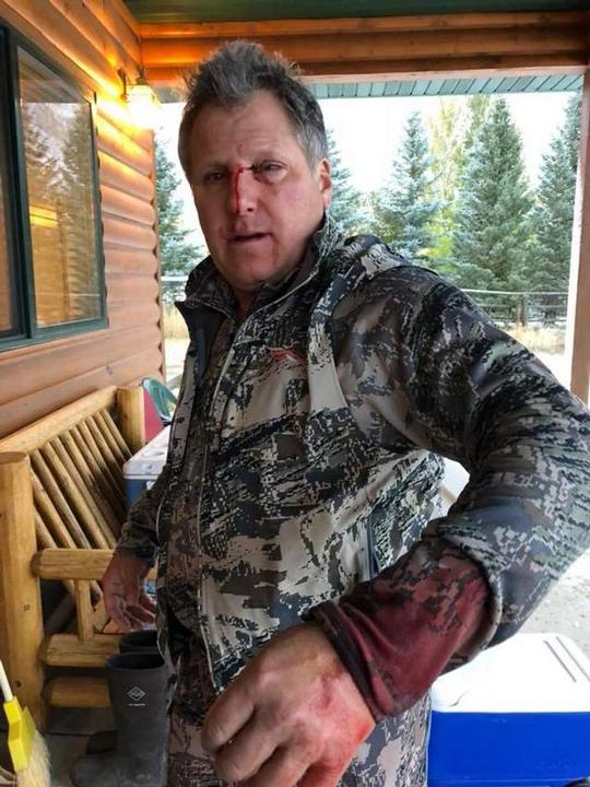 Montana bowhunter survives grizzly bear attack - 1