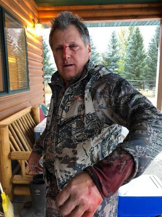 Montana hunter attacked