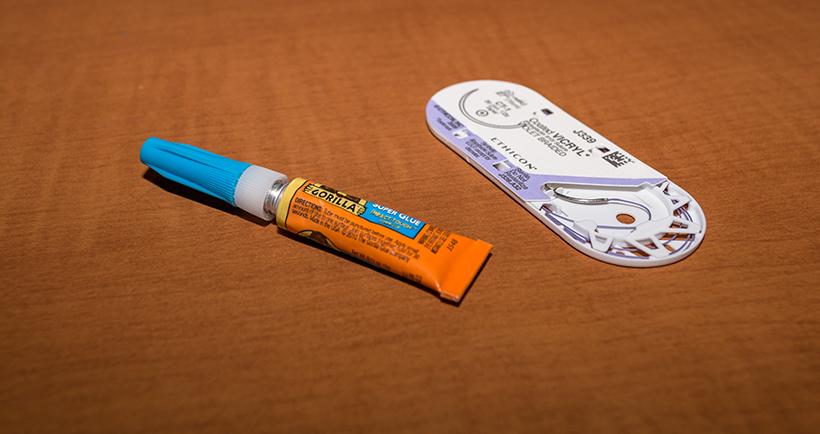 Sutures and super glue