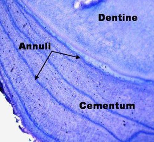 Cementum slide of a tooth showing growth rings